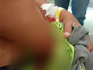 Funcionários da BRK são esfaqueados ao tentar cortar água de residência no Pilar