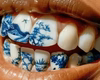 'Tatuagem' nos dentes vira moda entre jovens na China