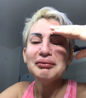 Romagaga chora ao perder conta de 1,6 milhão de seguidores no Instagram