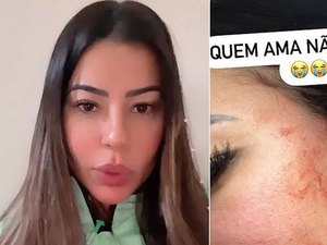 [Vídeo] Influenciadora de Penedo denuncia agressão do namorado e recebe solidariedade de Carlinhos Maia