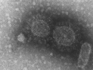 Lesões na pele podem ser indicativo de covid-19