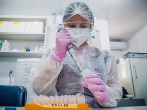Lacen recebeu mais de 29 mil exames RT-PCR em 2021 e liberou quase 28 mil resultados
