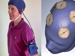 Memória perdida por Alzheimer é recuperada com chapéu magnético 