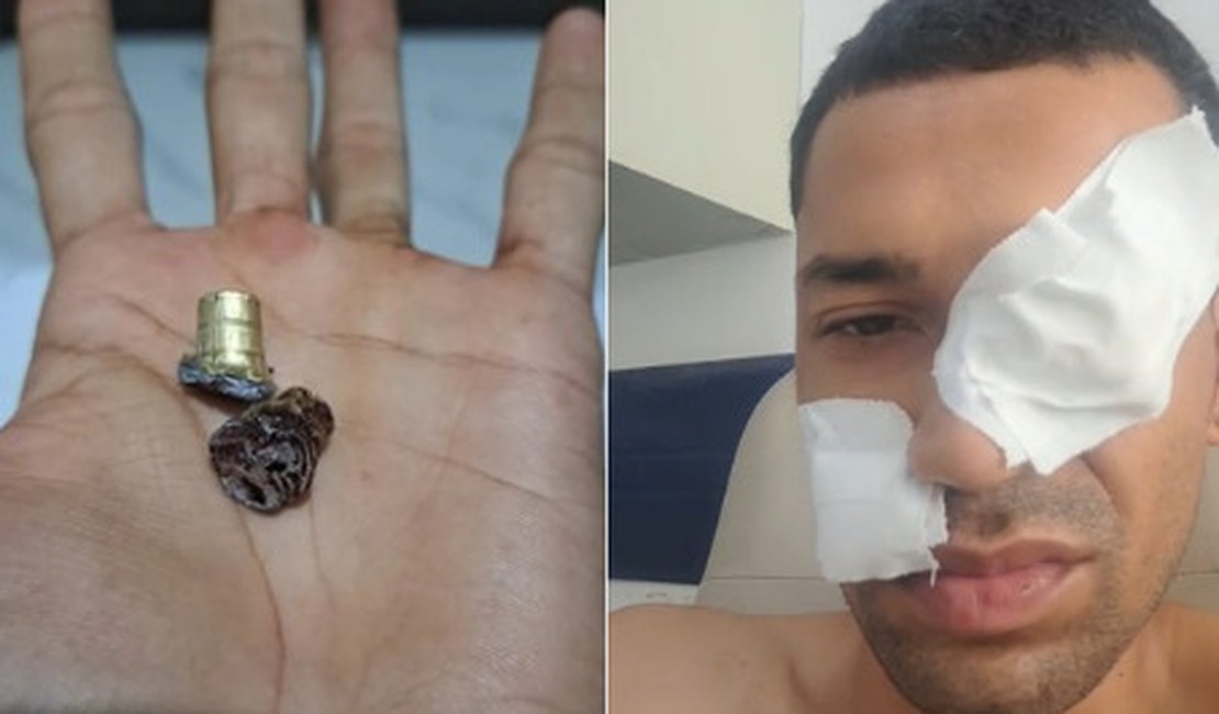 Homem sobrevive a tentativa de homicídio após ser baleado na AL-115, em Arapiraca