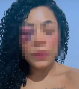 Pelas rede sociais, dançarina de Maceió mostra olho inchado e denuncia ex