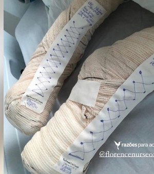 Enfermeira de Maceió viraliza ao fazer sapatinhos improvisados para aquecer pés de paciente