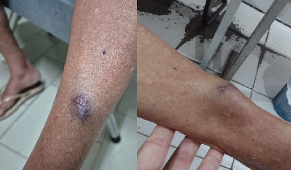 Médica é denunciada pelo MPAL por agredir tia idosa de 77 anos em Arapiraca