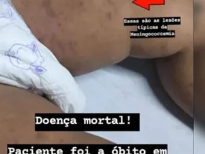 HGE confirma morte de bebê de um ano por meningite