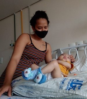 Após mais de 20 cirurgias na cabeça, bebê se recupera no HGE
