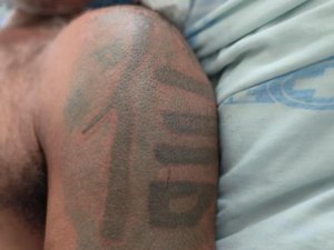 Hospital de Emergência do Agreste tenta localizar familiares de paciente sem identificação