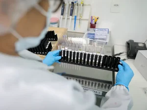 Malária: Anvisa autoriza teste em humanos de vacina 100% brasileira