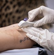 Saúde em Maceió disponibiliza inserção gratuita do Implanon