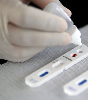 Britânicos que produzem vacina farão testes com 10 mil pessoas