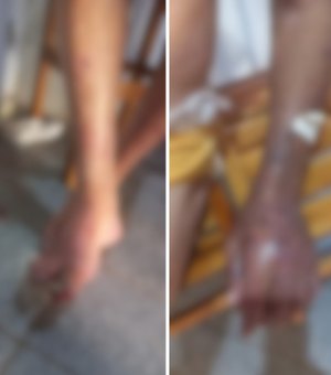 Idoso de 84 anos é encontrado ensanguentado e coberto por hematomas em Belo Monte; Filha é presa