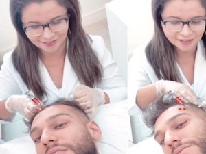 Lucas Lucco encara 'agulhadas' na cabeça para não ficar careca
