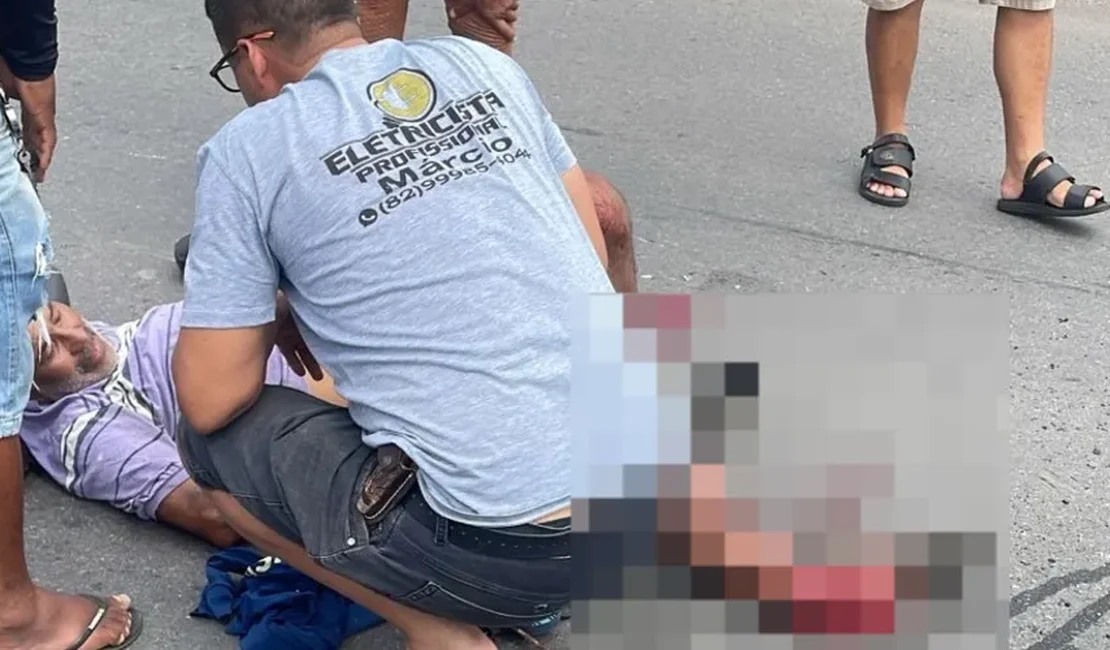 Idoso que se envolveu em acidente com ônibus na AL-110, em Arapiraca, teve a perna esmagada