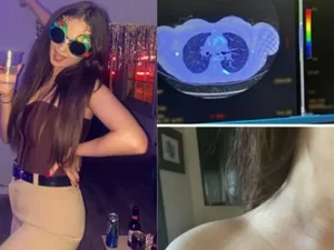Inglesa descobre que confundia sintomas de ressaca pós-festa com câncer