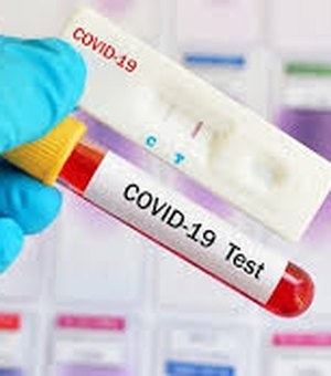 AL tem quase 25 mil casos de Covid-19, com 811 mortes