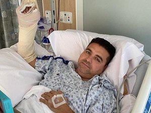 Buddy Valastro, o Cake Boss, tem mão prensada em acidente com boliche
