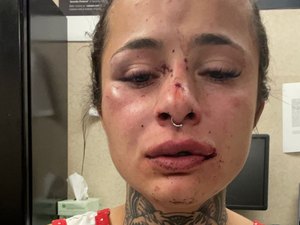 Tatuadora brasileira é espancada por namorado nos EUA e pede ajuda na internet