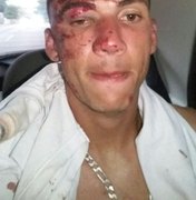 Goleiro do Coruripe é agredido durante tentativa de assalto em frente a sua residência