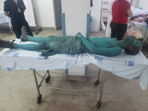 [Vídeo] Homem fantasiado de Hulk é atropelado na Av. Durval de Góes Monteiro