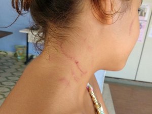 Menor é agredida por abrir janela de ônibus escolar