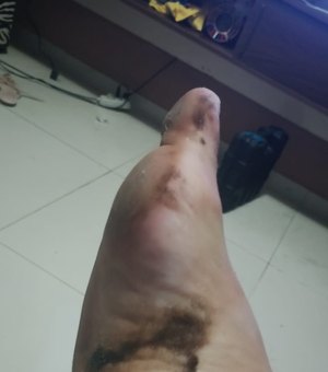 Manchas de óleo são encontradas na Praia do Francês, litoral sul de Alagoas