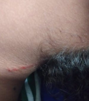 Adolescente de 14 anos é agredida por colegas de escola em Maceió