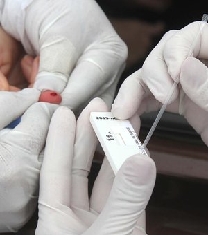 Testes de Covid-19 estão em falta nas farmácias e laboratórios de Arapiraca