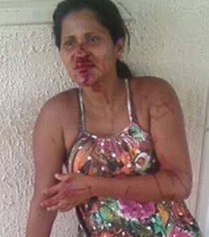 Grávida é agredida com barra de ferro no Sertão