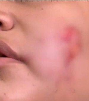 Homem agride mulher com mordida no rosto