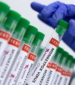 Maceió confirma 15º caso de varíola dos macacos