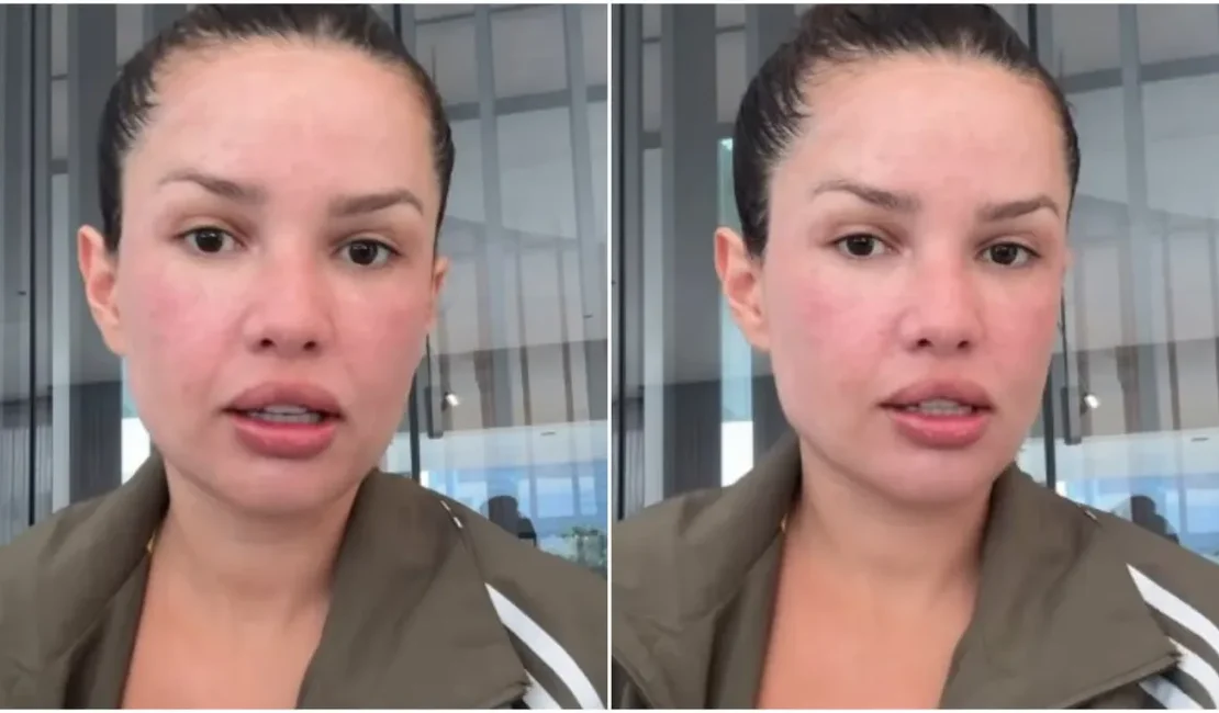 Juliette mostra rosto após procedimento com esperma de salmão; veja