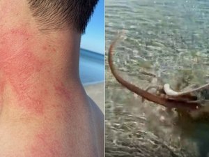 Polvo ataca banhista em praia na Austrália