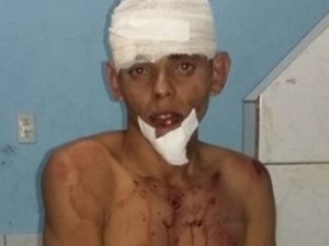 Jovem invade motel e é preso pela Rádio Patrulha