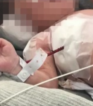 Bebê vítima de bala perdida na barriga da mãe nasce paraplégico, afirma secretário 