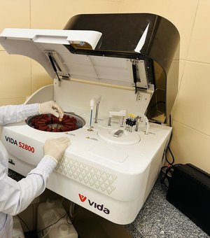 Hospital Regional de Palmeira dos Índios agiliza diagnósticos com exames realizados em até 30 minutos