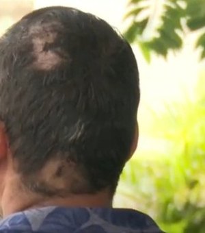 Taxista é agredido por passageiro com garrafa de vidro em Maceió