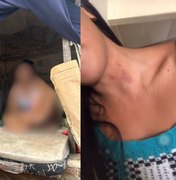 Adolescente diz que usava 'casinha de cachorro' para fumar e nega tortura: 'é um chupão'