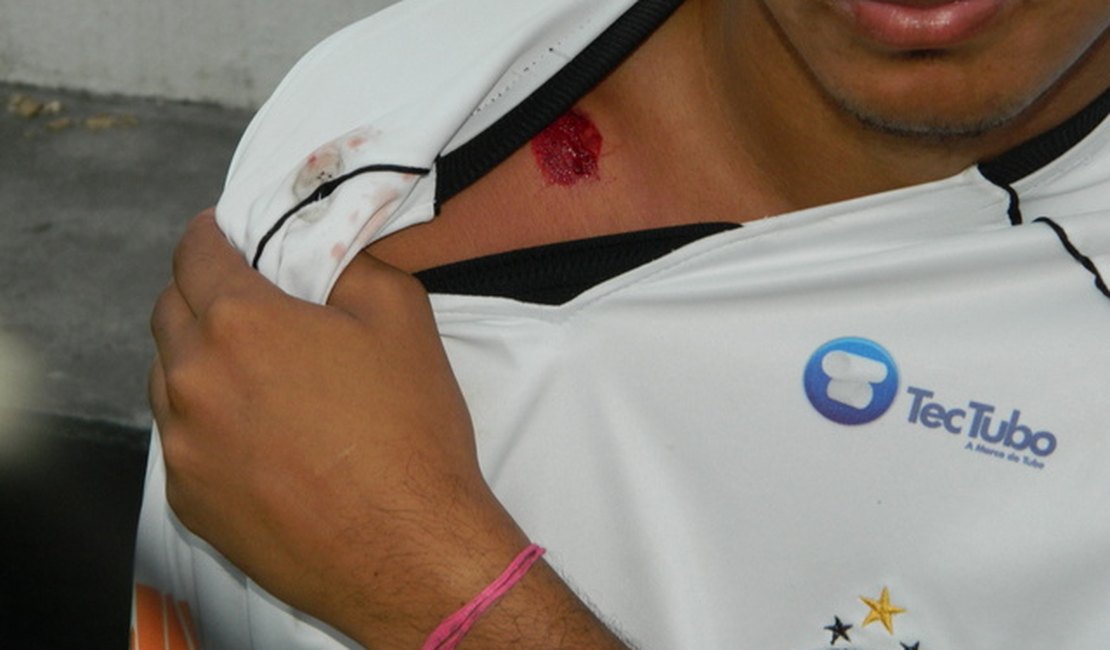 Menor acaba ferido por bala de borracha durante ação da Polícia Militar 