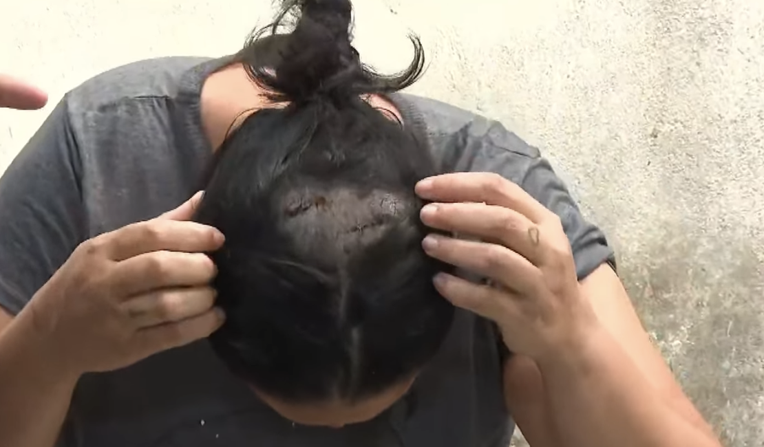 'Ele reclamou dos pratos sujos na pia', relata vítima de tentativa de feminicídio com facão em Junqueiro