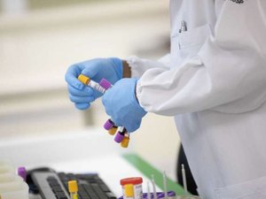 Anticorpos contra covid-19 duram pelo menos sete meses, mostra estudo