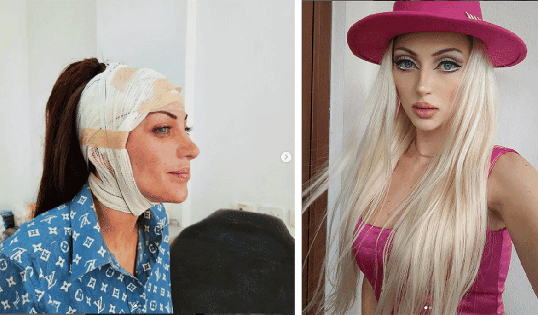 'Barbie humana': o que se sabe sobre influencer encontrada morta