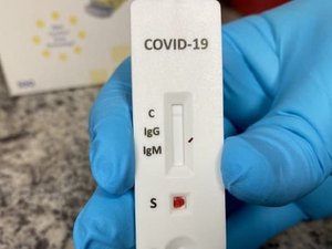 Covid-19: Quase 300 pessoas testam positivas em exames de farmácias em AL