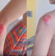 Jovem pula de moto por aplicativo após suspeitar de tentativa de estupro