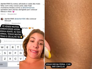 Lore Improta sobre estrias e celulite: 'Me amo com elas'