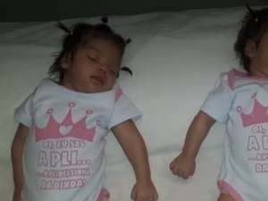 Gêmeas que não acordam desde que nasceram têm risco de sequelas