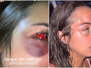 Polícia investiga agressão de três homens contra arquiteta