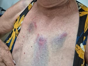 Médica que agrediu tia idosa de 77 anos é presa pela segunda vez em Arapiraca